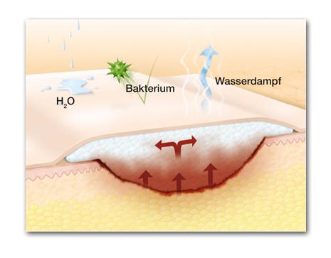 Suprasorb P