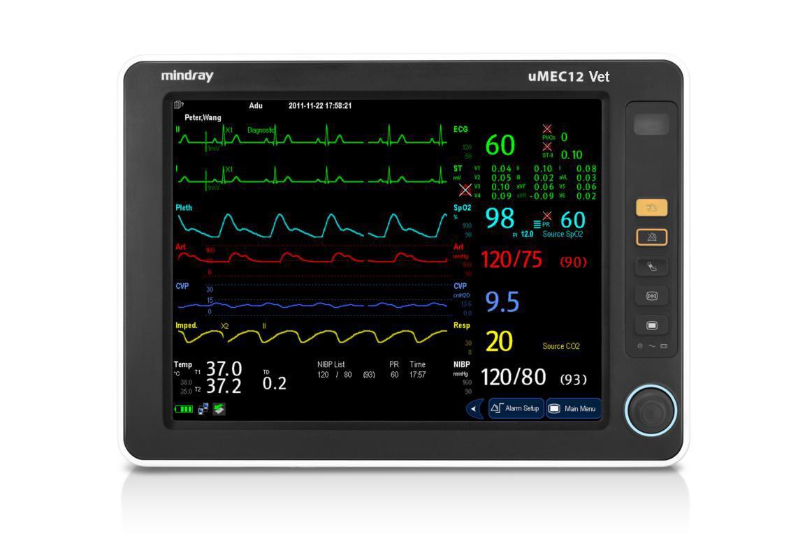 Mindray uMEC 12 "OP" Veterinär Patientenmonitor, 12,1" Touch, etCO2, EKG, SpO2, NIBP, Temp, Akku